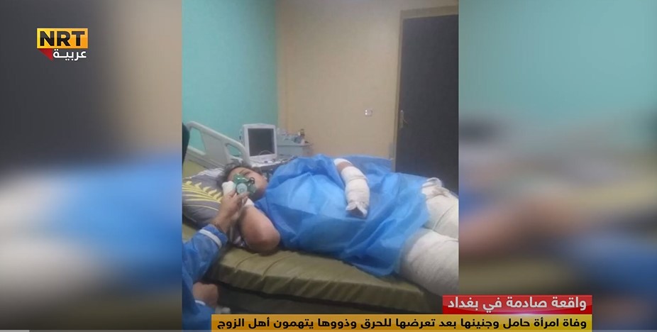بغداد.. وفاة امرأة حامل وجنينها بعد تعرضها للحرق وذووها يتهمون أهل الزوج
